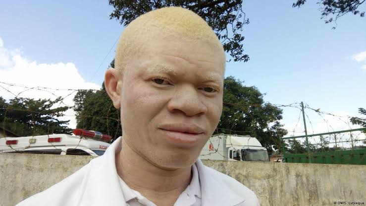RIASBLOG “Uncle kills albino for money ritual in Mozambique”.